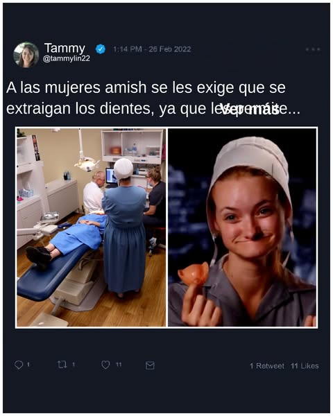 Ex-amish explican la tradición de la extracción de dientes