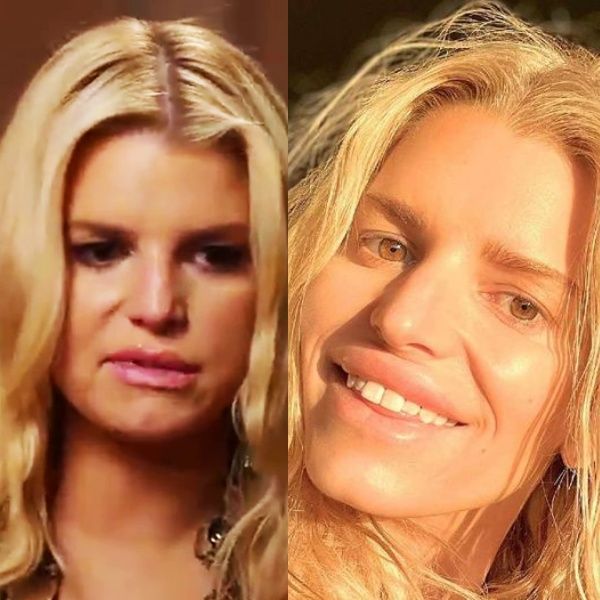 Jessica Simpson, que ahora tiene 43 años, finalmente ha revelado que se arrepiente de todas las cirugías a las que se ha sometido: aquí hay celebridades que no envejecen bien.