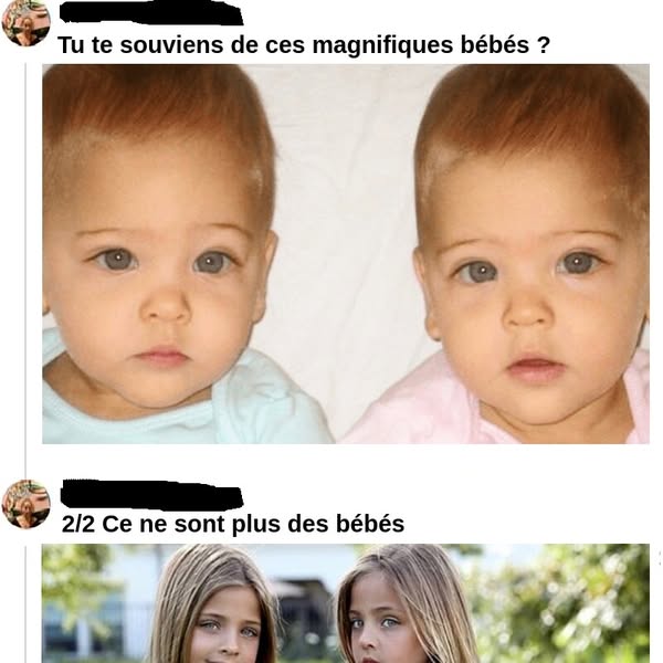 Les Magnifique Jumelles Qui Sont Devenues Célèbres Du Jour Au Lendemain